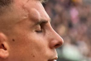 硬汉😨迪涅头上撞出一个清晰可见的大包，仍坚持比赛